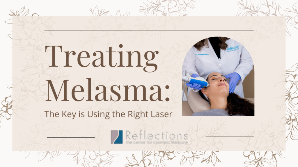 Treating Melasma Key is Using Right Laser