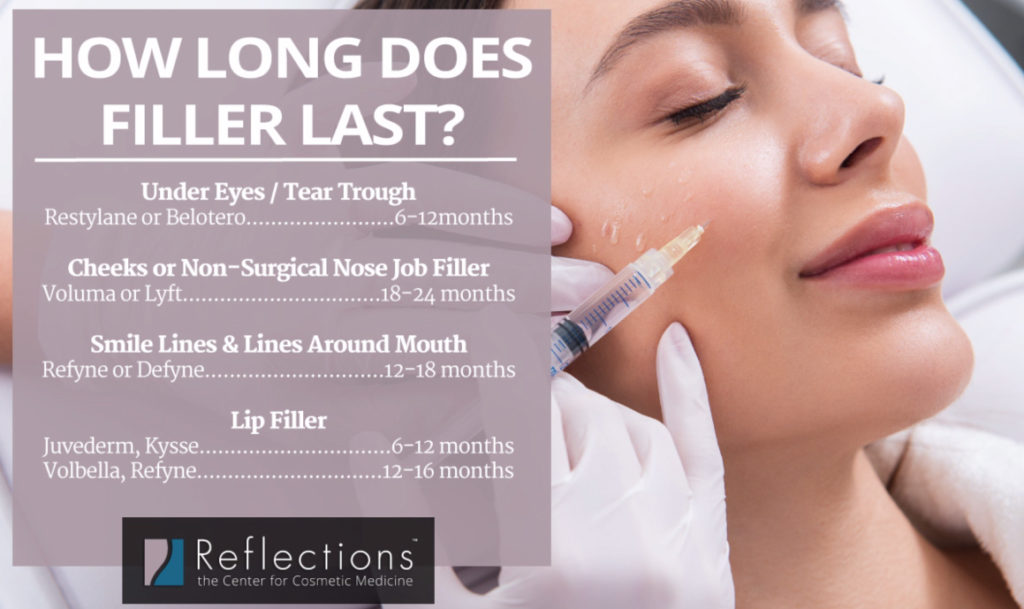 How Long Filler Lasts Based on Where It's Injected