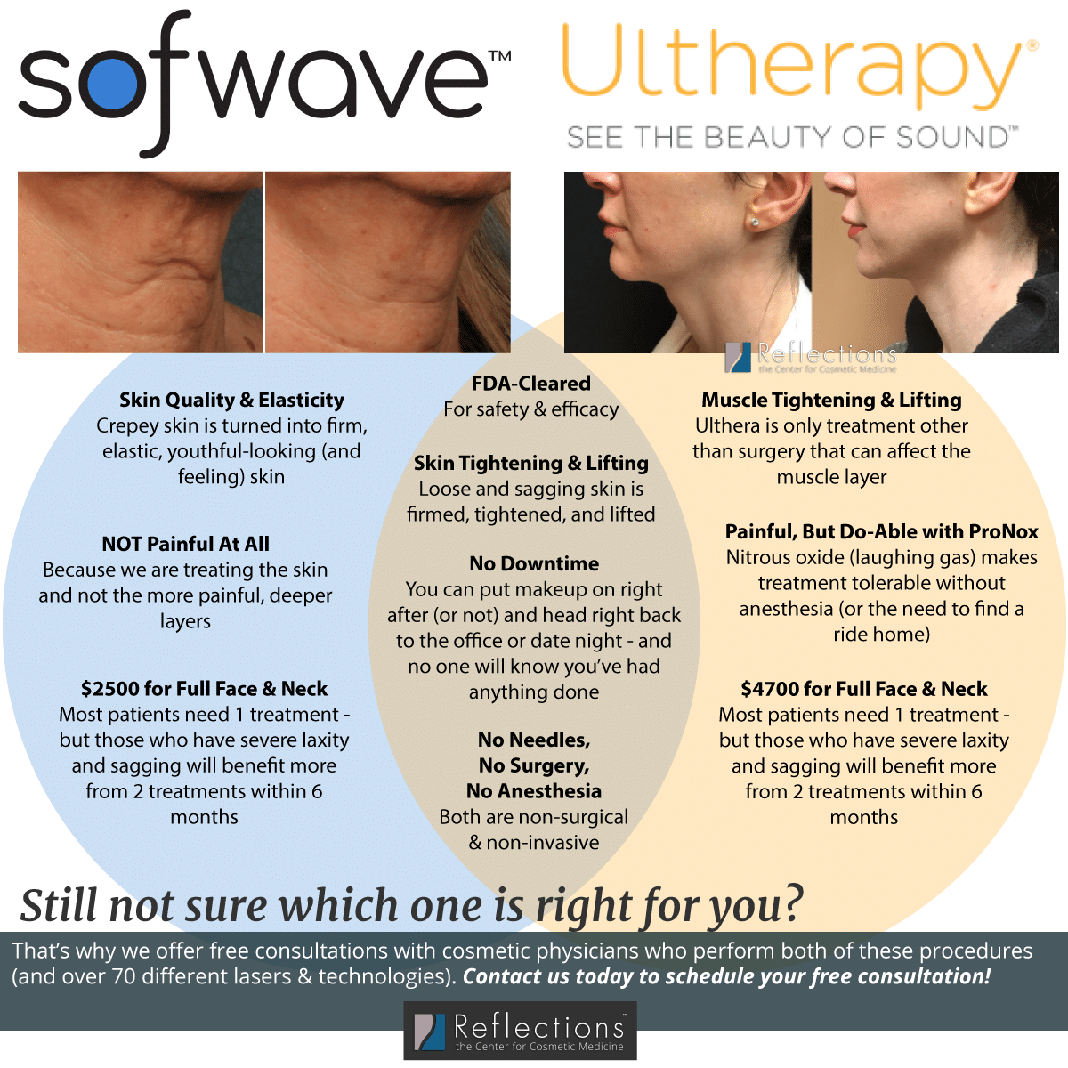 Ulthera vs Sofwave