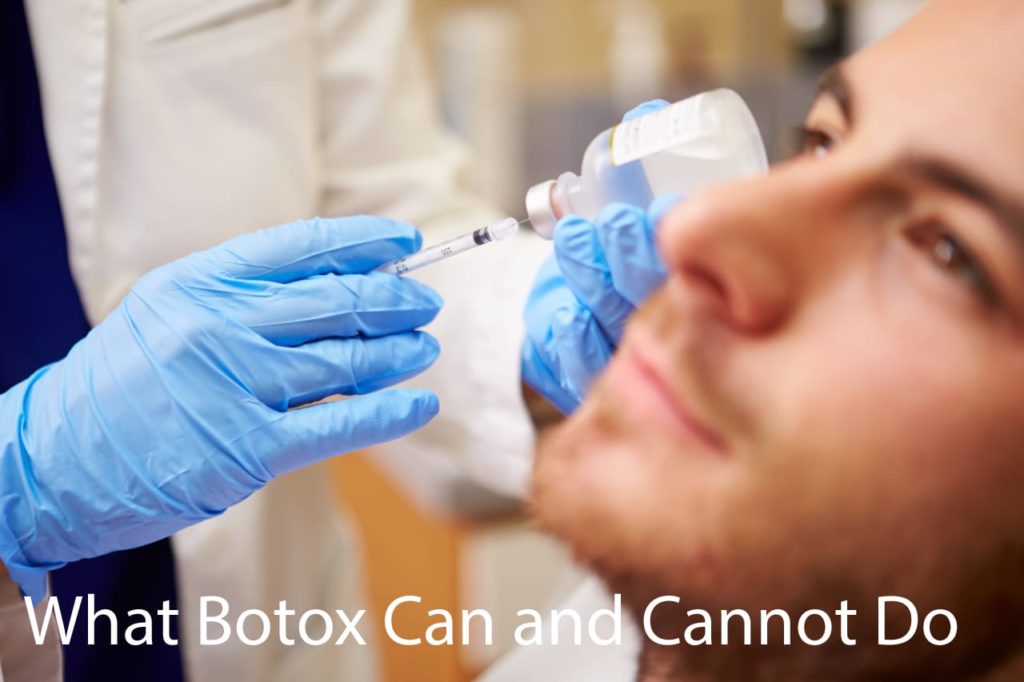 What Botox Can Do and Can't Do